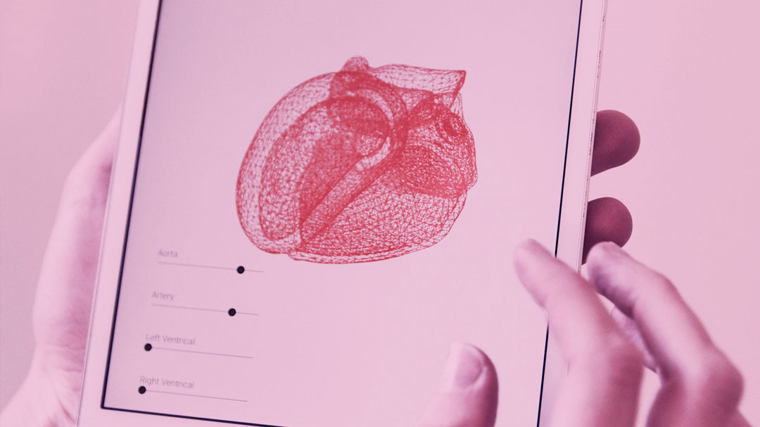 Corações impressos em 3D poderão ser usados no planejamento de cirurgias