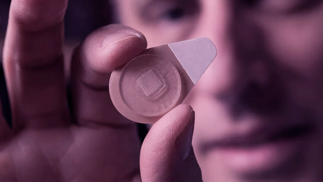 Adesivo com microagulhas fornece contracepção por um mês