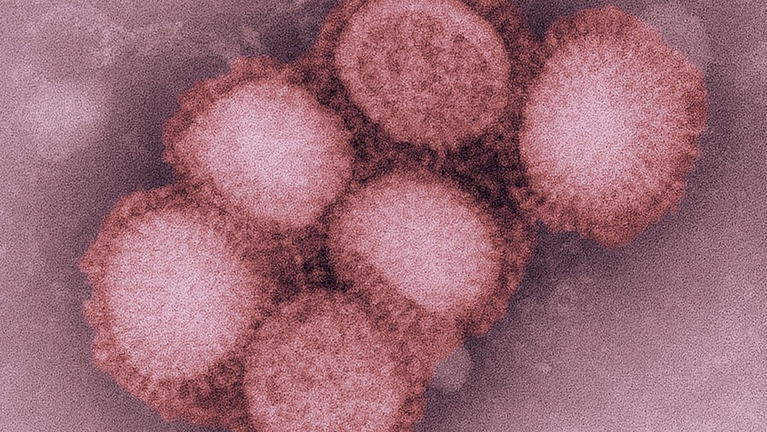 Pandemia: O novo coronavírus, fake news e a Gripe Espanhola na Netflix