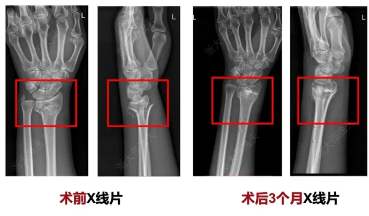 10 coisas que sabemos (até agora) sobre a "cola de ossos" chinesa